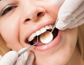 Particles-lodged-in-teeth-or-gums-north-york