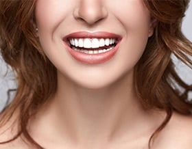 cosmetic-dentistry-natural-looking-fillers