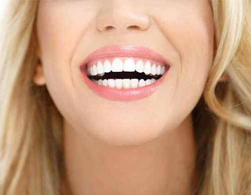 Enjoy a brighter smile North York