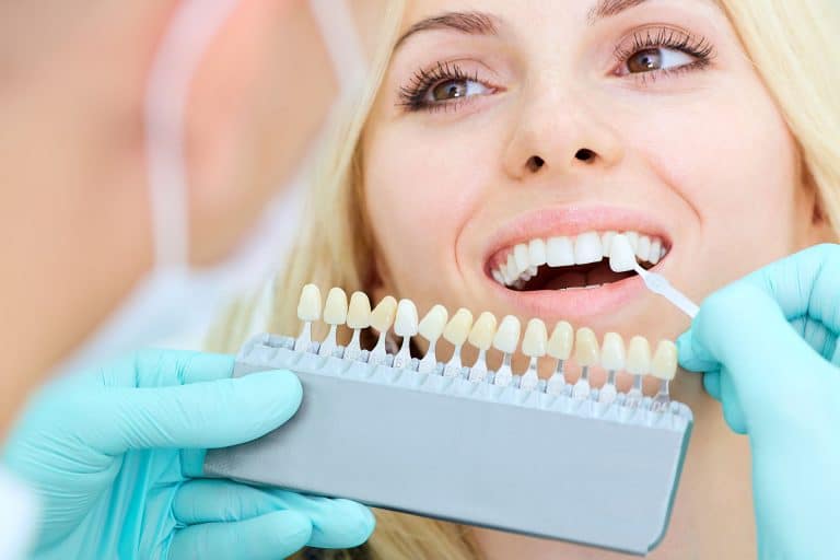 Same-Day Teeth Whitening in North York