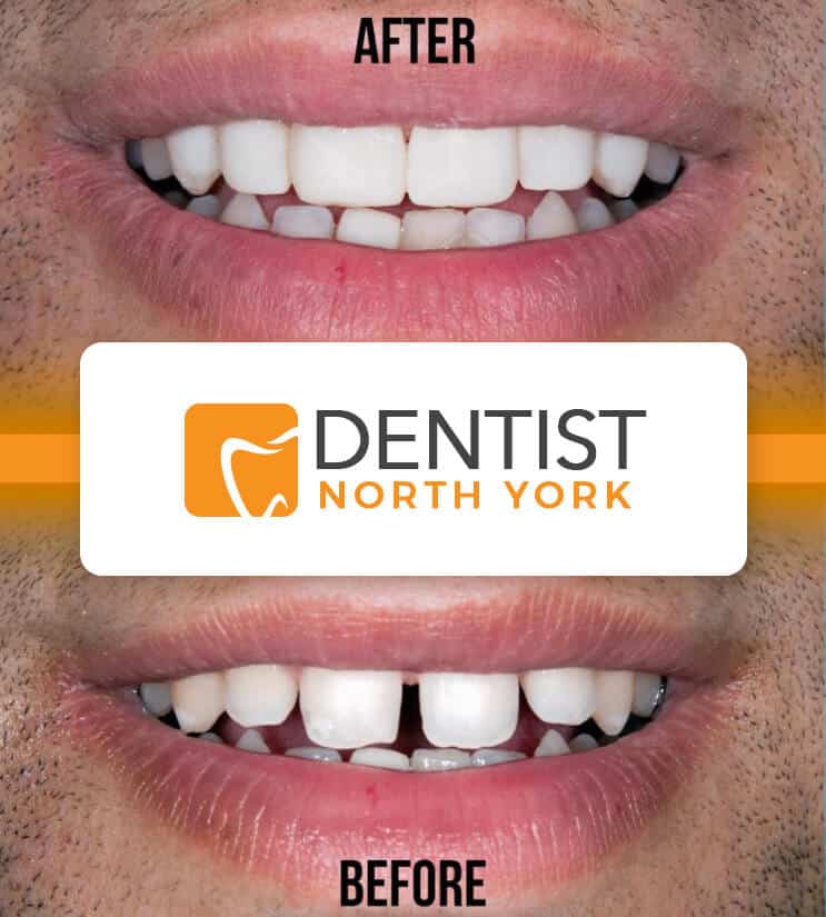 cosmetic dentist North York Ontario