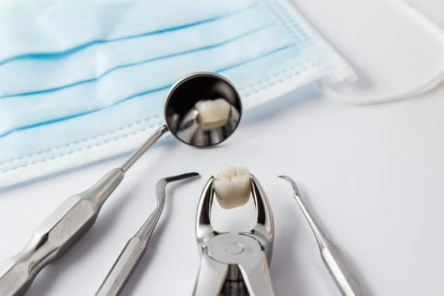 Everything You Need To Know About Wisdom Teeth Removal